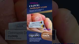 Clovig Antifungal Cream With Clotrimazole