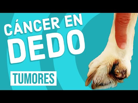 Video: Cáncer De Pie / Dedo Del Pie En Perros