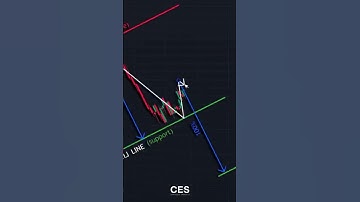 🧠 Head & Shoulders Pattern Explained