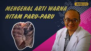 Kenali Penyebab Paru-paru Bisa Menghitam