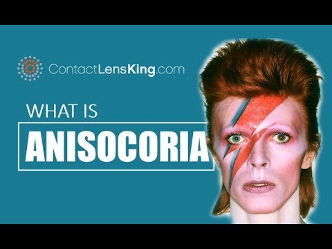 What is Anisocoria? Causes and Symptoms of Anisocoria.