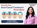 Stepbystep root canal treatment rct procedure  summirow dental