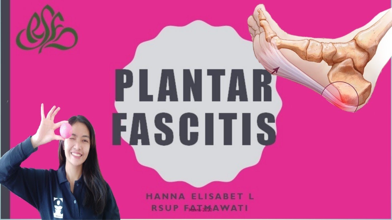 Sakit Telapak kaki || Penyebab dan Solusi Fisioterapi | Nyeri Plantar