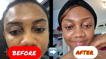 Why Your SKINCARE Routine Isn