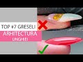 Top #7 greșeli în Arhitectura Unghiei