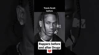 Travis Scott before and after drugs 💔 #travisscott #shorts #funny #youtubeshorts #india #instagram
