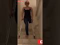 Amputee lady one-legged descending stair #walking