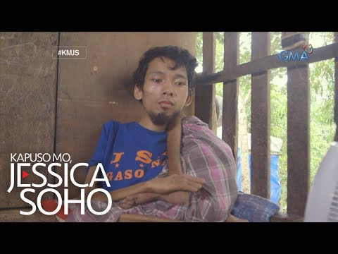 Video: Sino ang mga batang may kapansanan sa orthopedically?