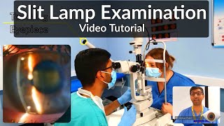 Slit Lamp Exam Tutorial - Part 1