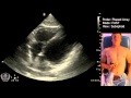 Fast scan focused assessment with sonography in trauma  step by step