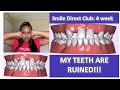 Smile Direct Club 4 week review | ARE MY TEETH RUINED!?!?!?