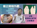 【拇指外翻】在家自助的改善方法3選！