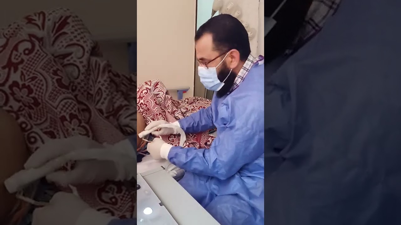 بزل السائل البريتوني ( الاستسقاء) عن طريق الموجات الصوتية. Ultrasound guided paracentesis