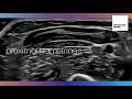 How to scan the proximal hamstrings? | MSK Ultrasound Tutorial
