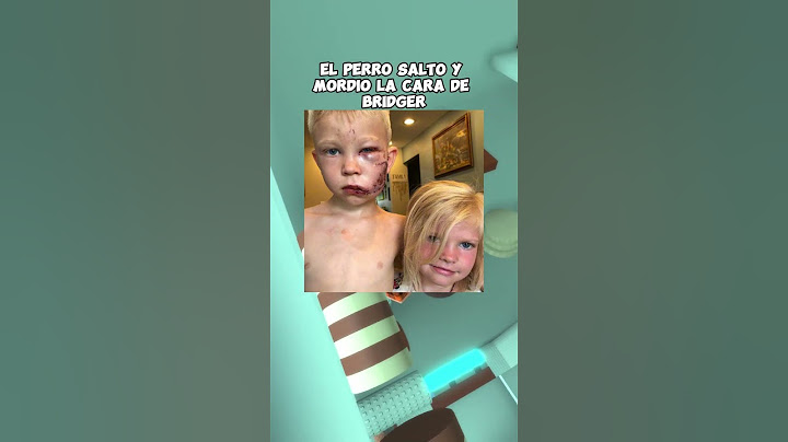 Niño de 6 años enfrenta a un perro para salvar a su hermana 🐕💪❤️