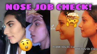 🤯 Tik tok Nose Job Check Trend 😯 The most incredibles before and after