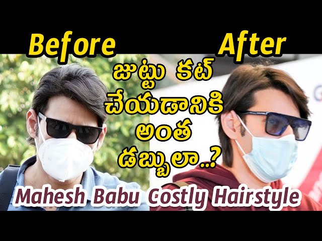 South Indian actors who got hair transplant | mirchiplus