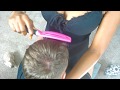 Asmr dandruff scratch hair partingtreatment with headscalp massage