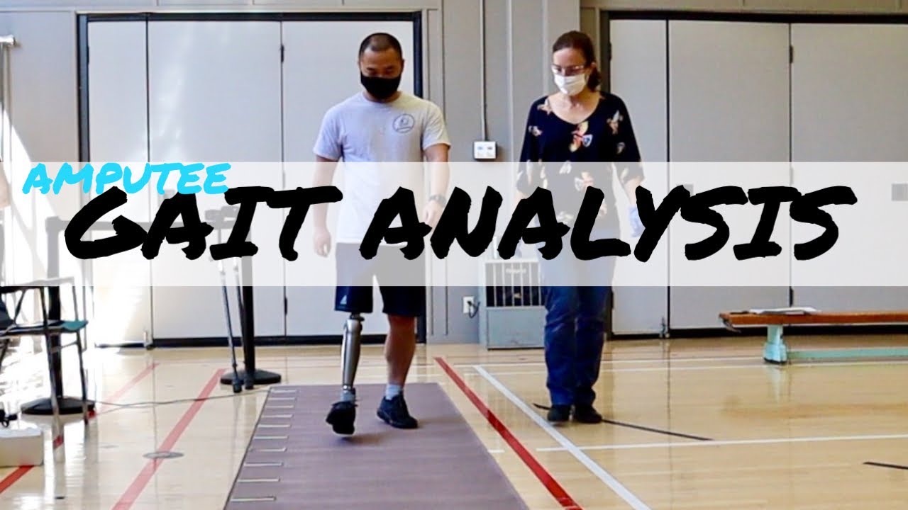 Hip Disarticulation Amputee: Ottobock C-leg Gait Analysis/다리절단: 오토복 씨렉을 이용한 보행분석 [캐나다 재활 🇨🇦] (자막)