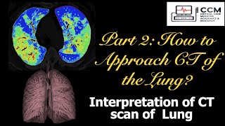 Interpretation Of Ct Lung: Part 2 - The Approach