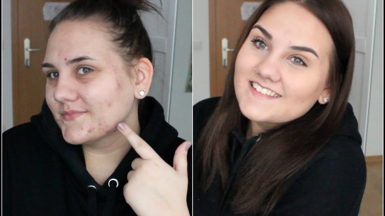 10 Minuten Akne Morgen Routine Schul Make Up Haare Youtube