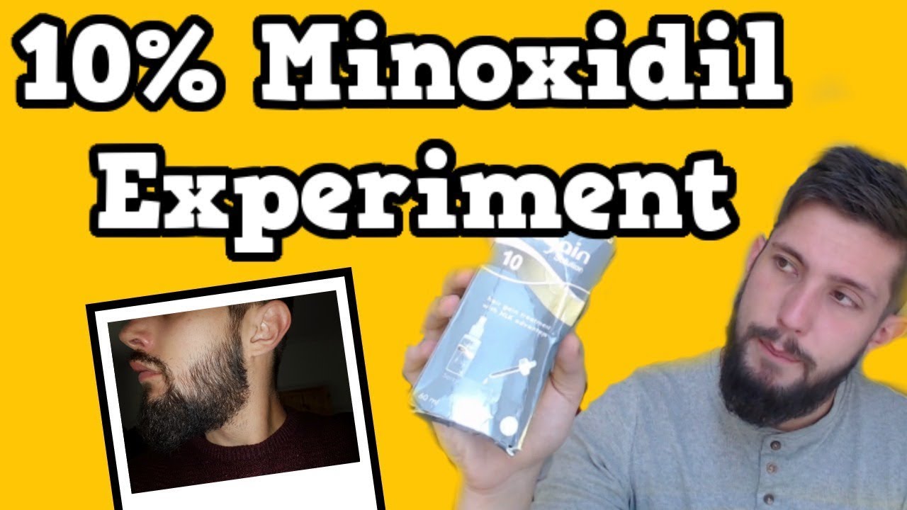 Minoxidil | 3 Month Journey | Beard - YouTube