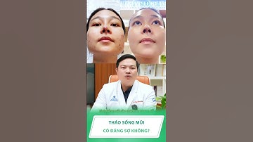Bác sĩ Phùng Mạnh Cường giải thích: Tháo sống mũi có thật sự đáng sợ? #lamdep #shorts #nangmui
