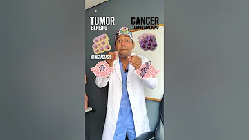 ¿Cuál es la diferencia entre una masa y un tumor?