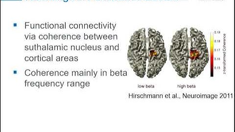 OHBM 2018 | Symposium | Esther Florin | Functional connectivity in human electrophysiological reco…