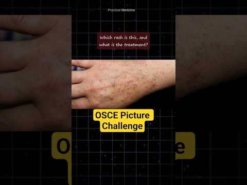 [OSCE: Picture] What is the diagnosis?