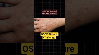 [OSCE: Picture] What is the diagnosis?