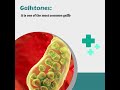 5 common types of gallbladder problems  dr susenjit prasad mahato