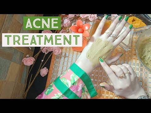Easiest Way To Remove Acne "Scars and Spots" (Homemade Acne Treatment)