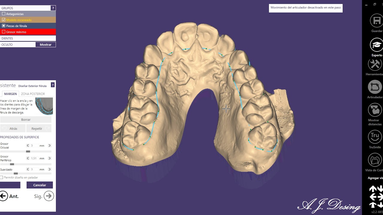 Exocad - 011 Férula de descarga