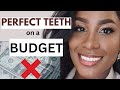 How to get BEAUTIFUL TEETH on a BUDGET