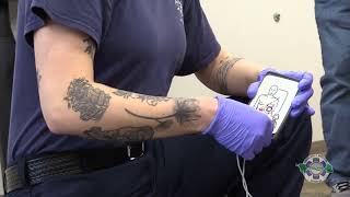 Anterior Posterior: Early Placement of the Lucas Device