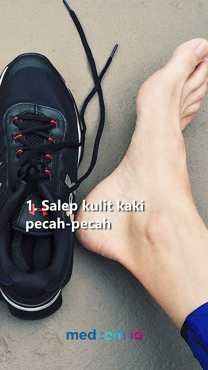 3 CARA MENGOBATI TUMIT KAKI PECAH-PECAH