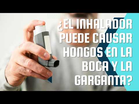 ¿El Inhalador Puede Causar Hongos en la Boca y la Garganta? | Dr. Luis Felipe Felipe