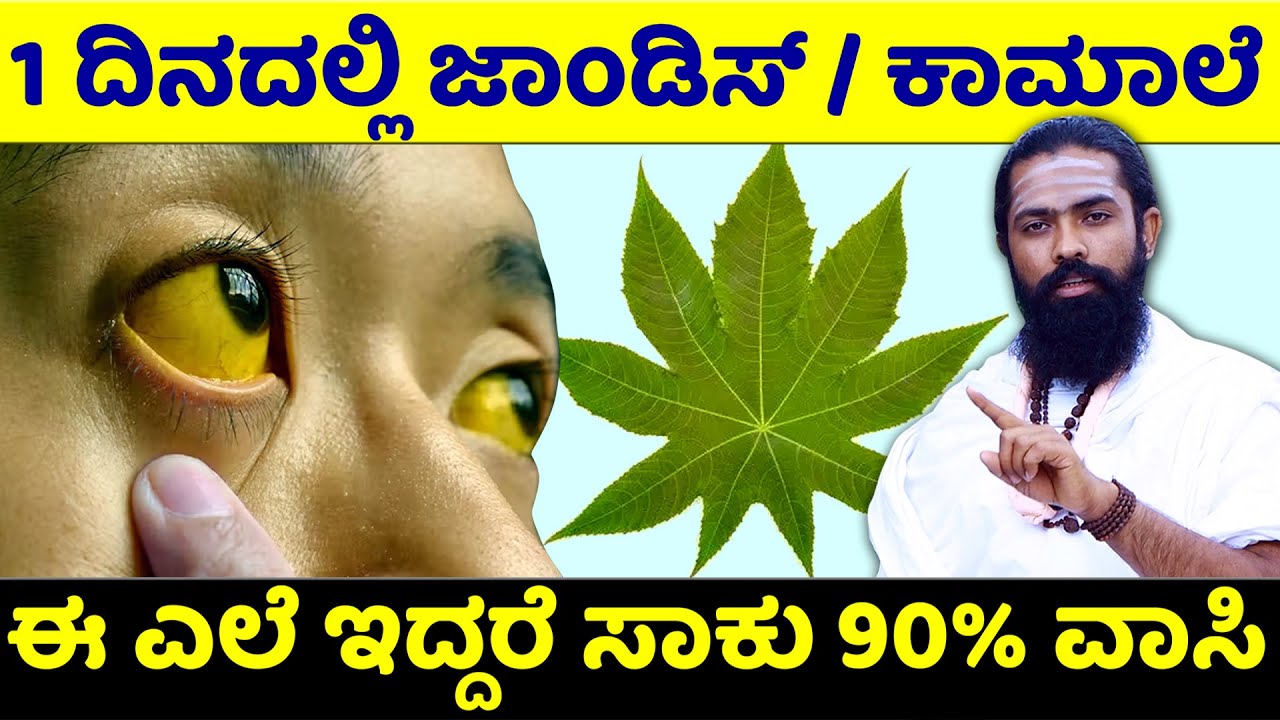 ಔಡಲ ಎಲೆ ಜಾದು ನೋಡಿ | Kamale Rogakke Mane Maddu | Jaundice Mane Maddu | Haralenne Uses in Kannada