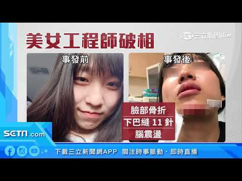 逆向害摔又肇逃　正妹骨折縫11針慘破相｜三立新聞台