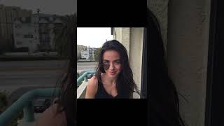 Beautiful Insecurities Birth Marks 16