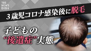 【LIVE】「風邪と同じは“暴論”」子どもにもコロナ後遺症「ぼく、どうなっちゃったの？」| TBS NEWS DIG