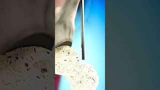 How Your Body Heals a Broken Bone!!!