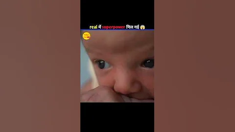 Got real superpower after accident 🥶| #shorts #ytshorts