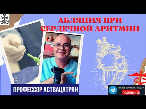 Абляция при сердечной аритмии