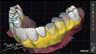 Удалённая установка Ceramill Mind / Maestro3D / Millbox | CAD/CAM