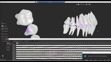 OrthoPlus Full Workflow with CBCT