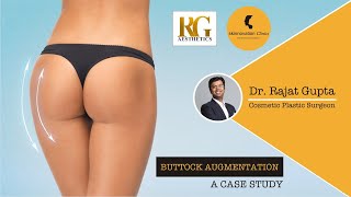 Buttock Augmentation Surgery Results | Dr Rajat Gupta | Skinnovation Clinics