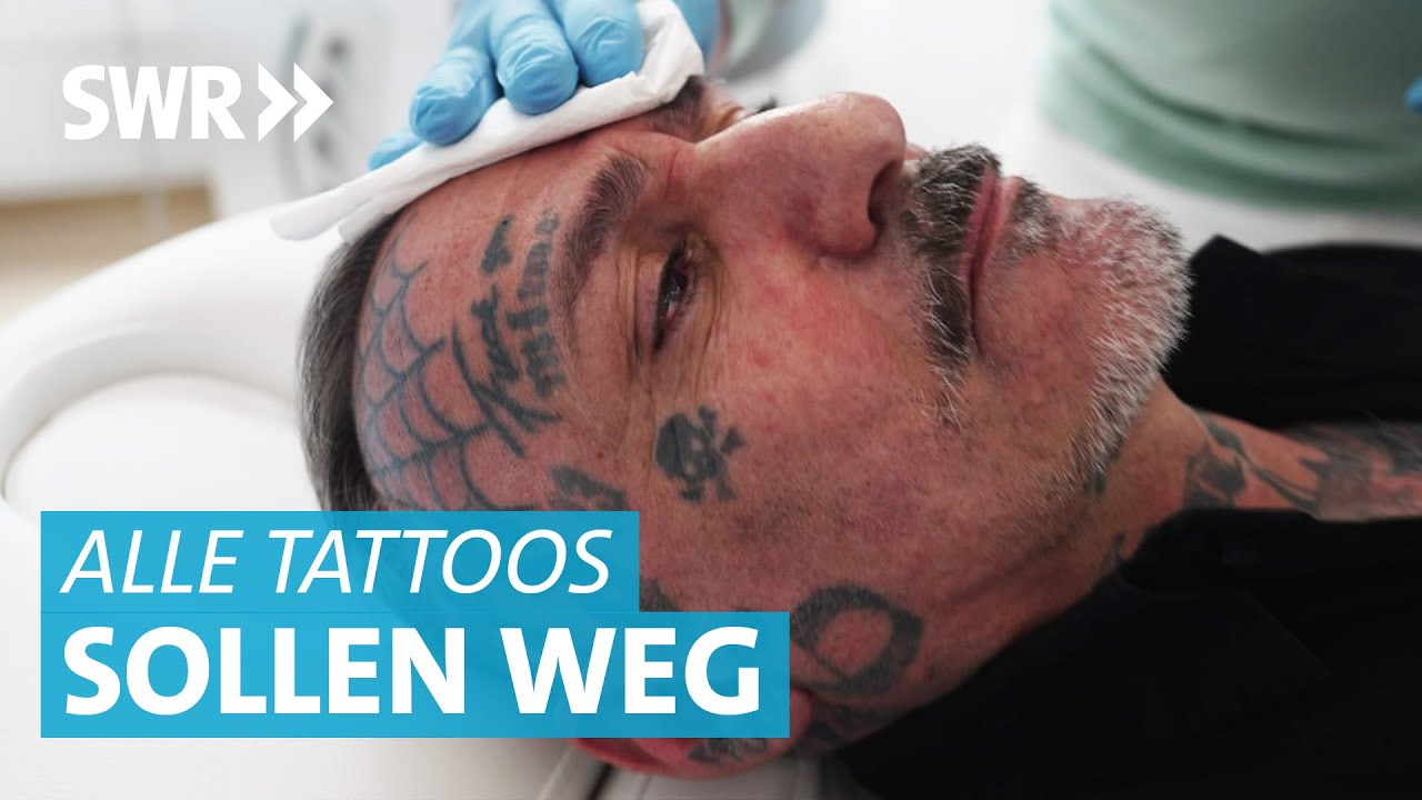 Tribal Tattoos, Augenbrauen Tattoos und Gesichtstattoos: Tattooentfernung durch Laser in Mannheim