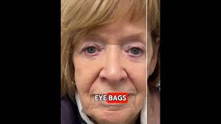 EYE280 ITN 227 AVATAR VRTN Avatar 1 EyePods Video EAR Problem Aware